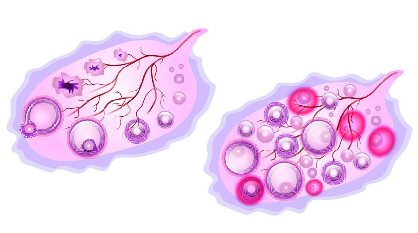 Fundus nedir ve ideal fundus değeri ka&ccedil; olmalıdır?
