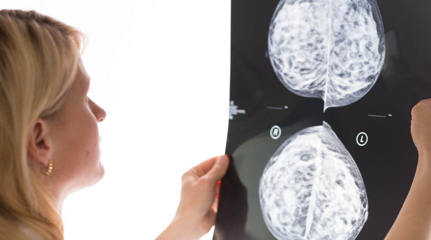 Fibrokistik meme oluşumu neden olur? Belirtileri nelerdir?