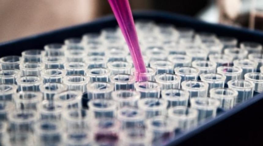 GFR değeri nedir? Normal değerler kaç olmalıdır?