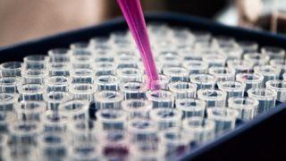 GFR değeri nedir? Normal değerler kaç olmalıdır?