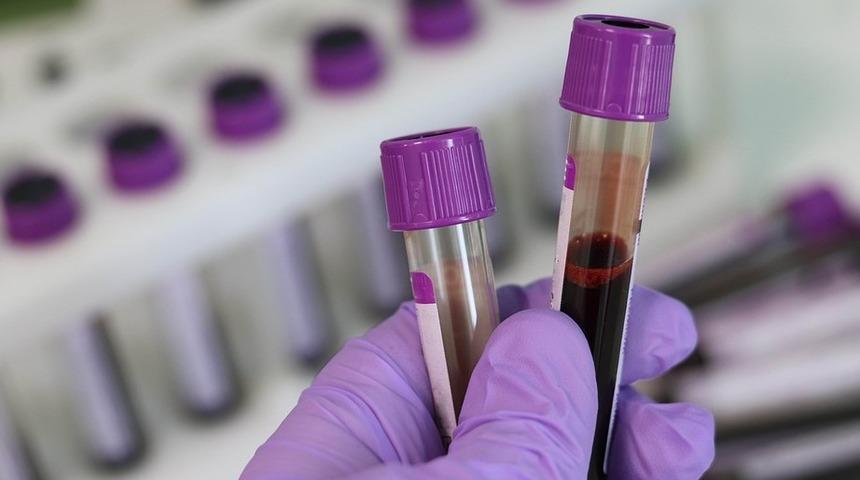 Prolaktin (PRL) hormonu: Nedir ve nelere dikkat edilmelidir?