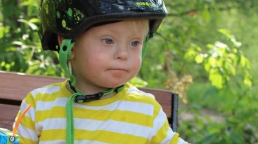 Down sendromu bir hastalık mıdır? Nasıl anlaşılır?