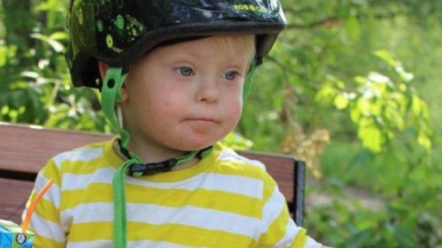 Down sendromu bir hastalık mıdır? Nasıl anlaşılır?