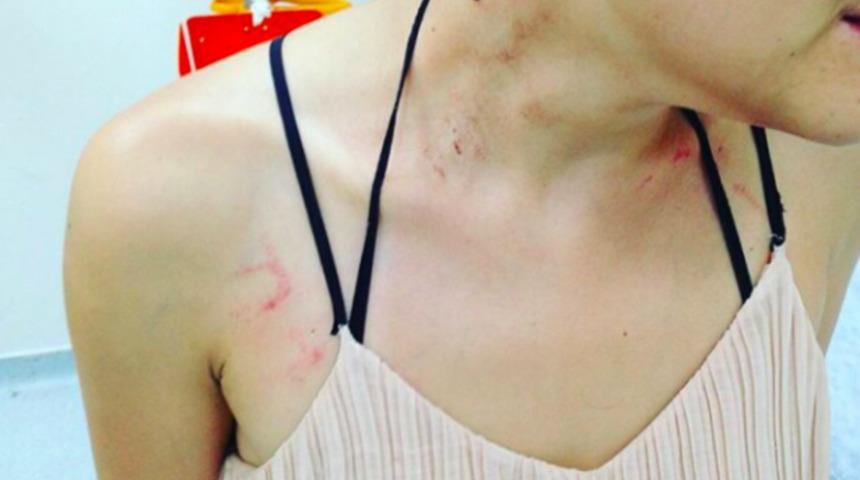 Şiddete uğrayan bu ka&ccedil;ıncı kadın!: M&uuml;zisyen G&uuml;lşah Erol Kadık&ouml;y&rsquo;de polisin saldırısına uğradı! 