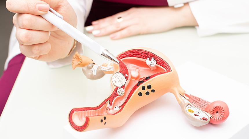 Rahim duvarı kalınlaşması neden olur? Belirtileri nasıl anlaşılır?