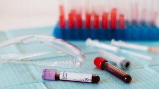 Estradiol hormonu nedir? Estradiol testi nasıl yapılır? 