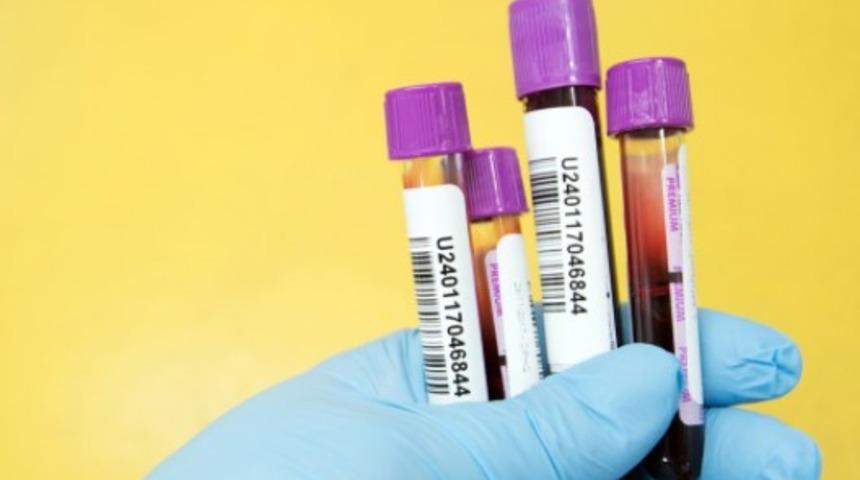 AST nedir? AST neden yükselir ve neden düşer?