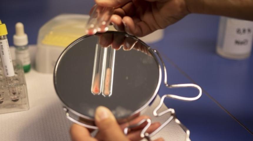 EGFR nedir? GFR normal değerleri kaç olmalıdır? EGFR yüksekliği ve düşüklüğü ne anlama gelir?