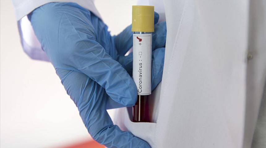 Premier Lig'de Burnley-Fulham ma&ccedil;ına Kovid-19 engeli