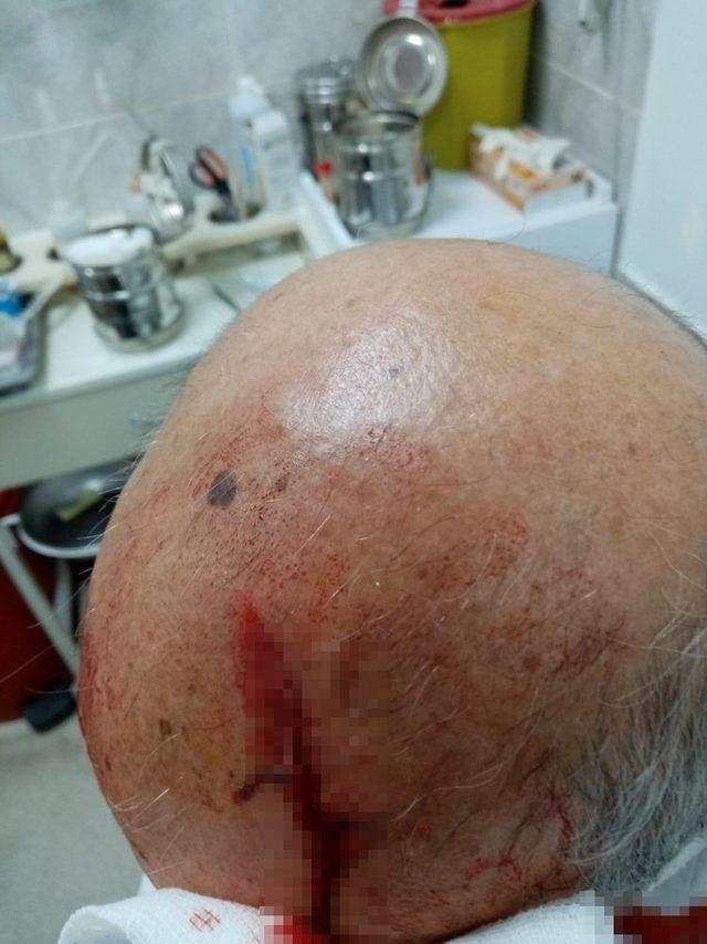 İzmir&rsquo;de doktora taşlı saldırı: Maske uyarısı yapan doktorun kafasını yardı 1