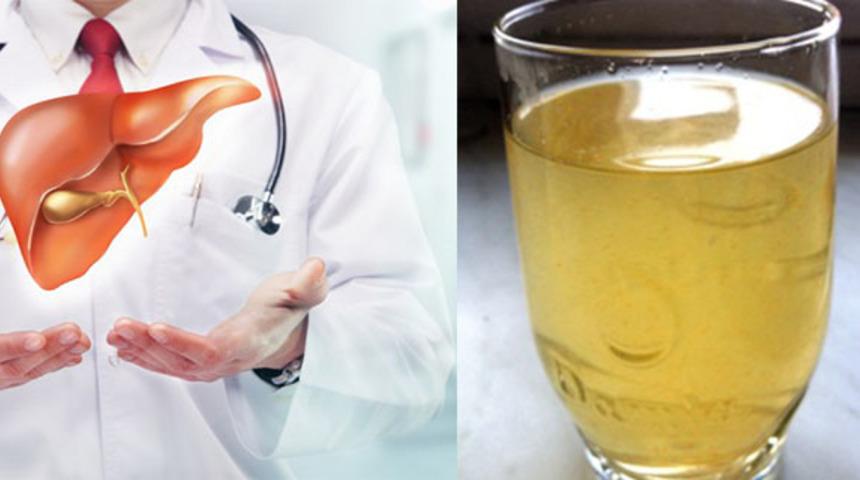 Karaciğeri en az 5 yaş gençleştiren mucize limonata