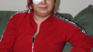 Alerji olan kadının derisi döküldü, sağ gözü görme kaybı yaşadı