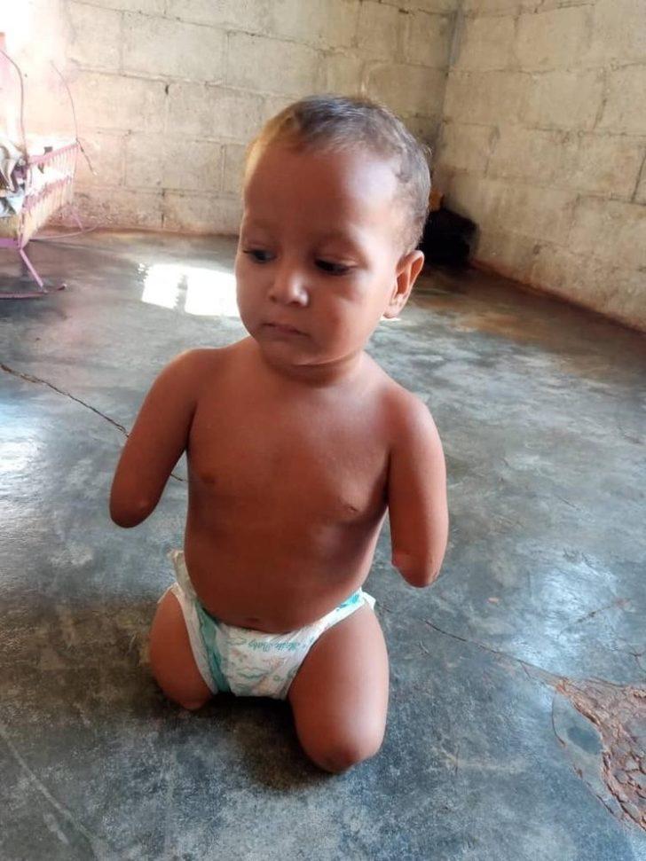 Savaşın çocuklarına protez takarak hayata bağlanıyor G3