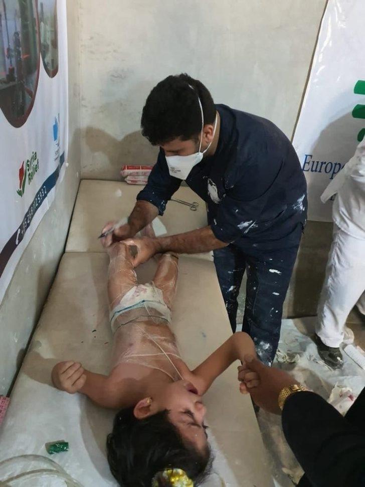 Savaşın çocuklarına protez takarak hayata bağlanıyor G4