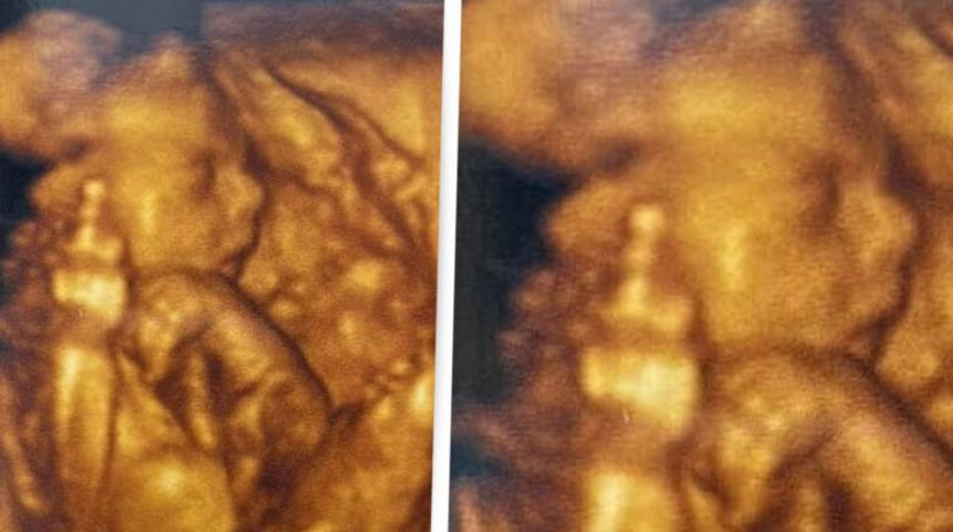 Doğmamış bebek orta parmağını kaldırarak &ldquo;2020&rsquo;ye hoş&ccedil;a kal&rdquo; dedi