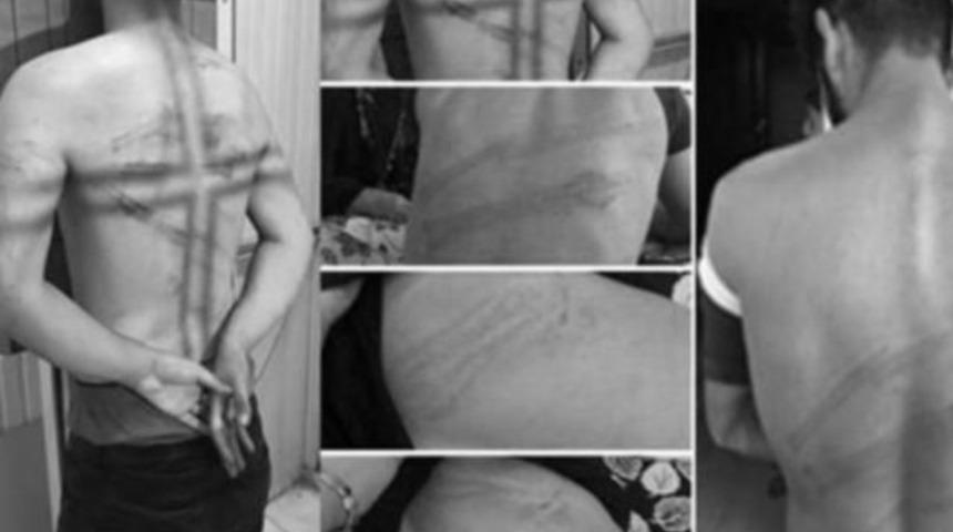 Şemdinli'de bir polis darp iddiasıyla a&ccedil;ığa alındı