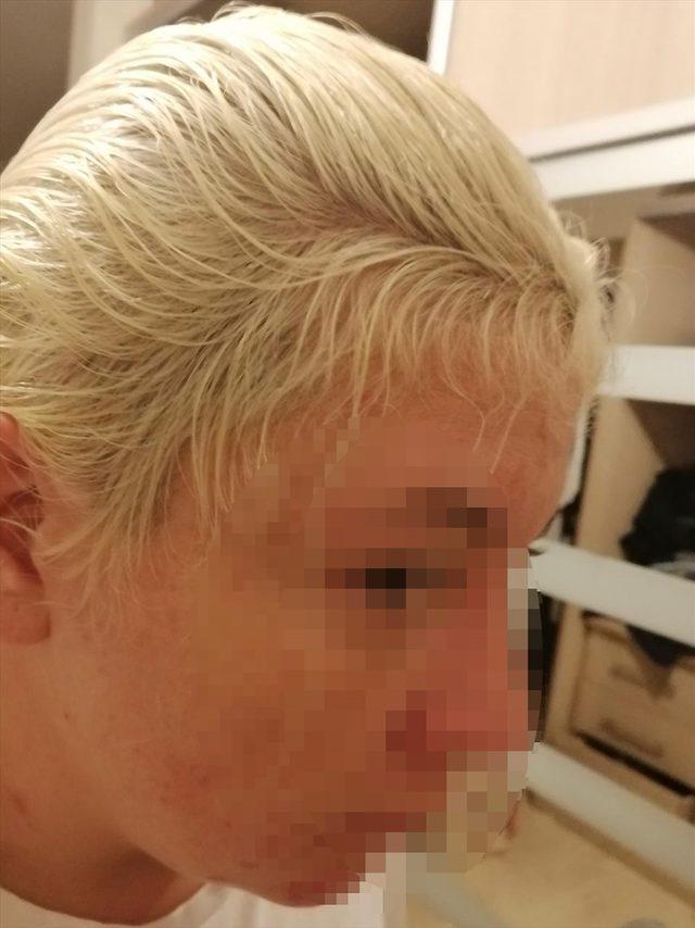 Kocaeli'de boyattıktan sonra saçları dökülen kadın avukat, kuaförden şikayetçi oldu