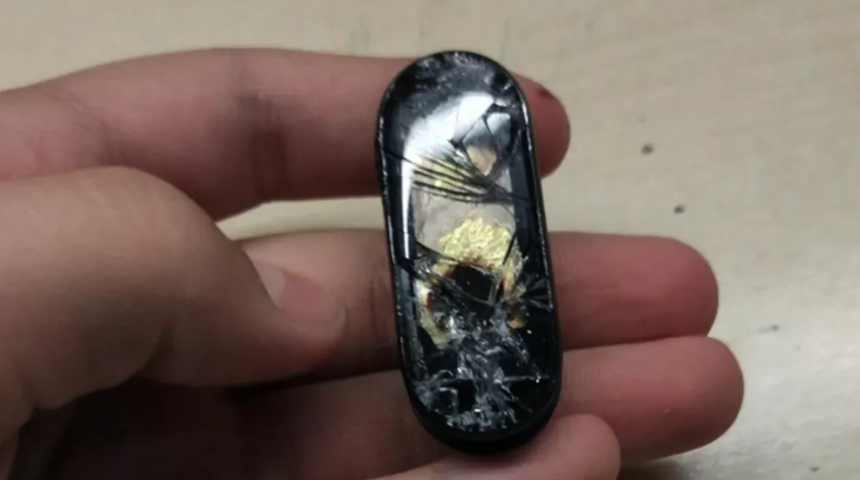 Xiaomi Mi Band 5 akıllı bileklik şarj olurken patladı!