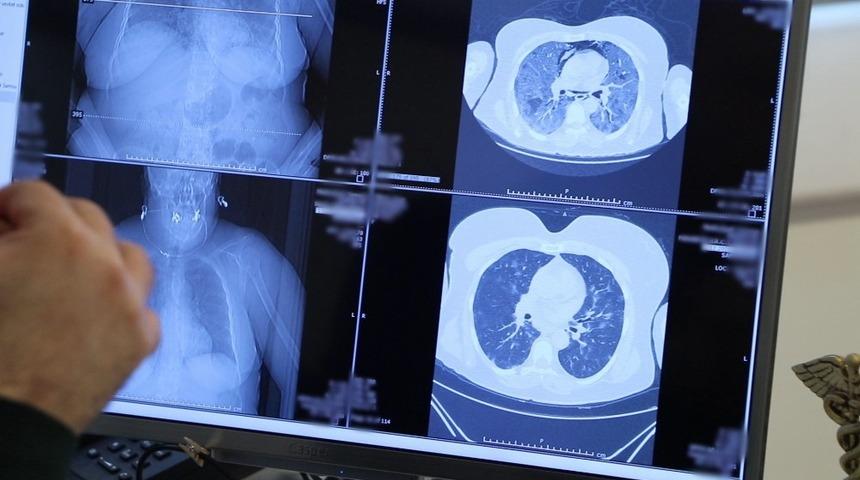 Dikkat çeken açıklama: Son aylarda aile içi bulaşın çok hızlı olmasında mutasyonlu virüs olabilir