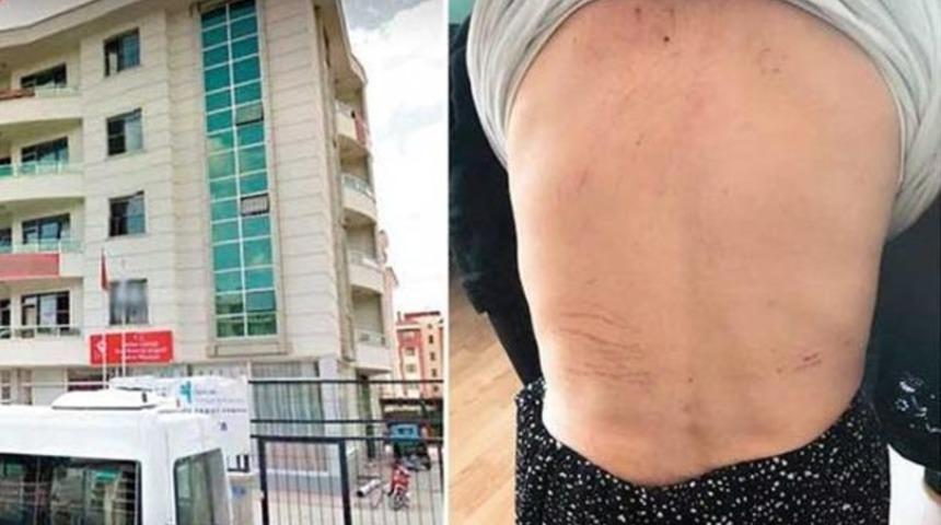 Konya bakımevinde dehşet: Engellilerin &uuml;zerinde sigara s&ouml;nd&uuml;rd&uuml;ler