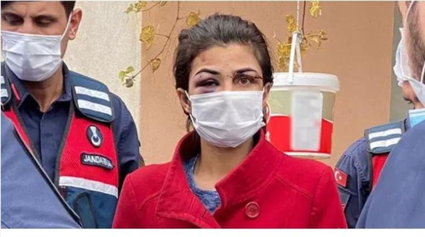 İşkence yapan eşini &ouml;ld&uuml;ren Melek İpek i&ccedil;in sosyal medya ayağa kalktı: Serbest bırakın