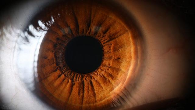 Retina yırtılması belirtiler vitre dejenerasyonu ile başlıyormuş! 