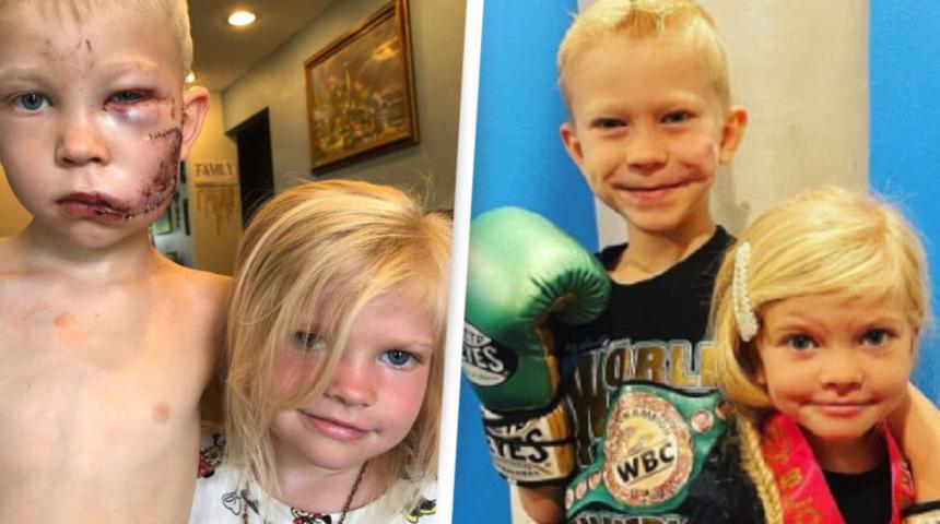 Kız kardeşini k&ouml;pek saldırısından kurtaran kahraman &ccedil;ocuk y&uuml;z&uuml;ndeki yaralar i&ccedil;in tedavi g&ouml;r&uuml;yor