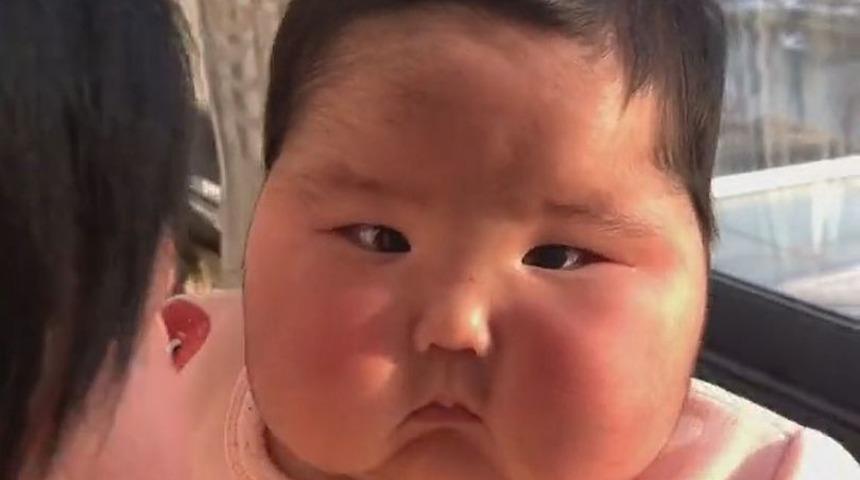 Steroid kremden sonra bebeğin y&uuml;z&uuml; balon gibi şişti ve t&uuml;ylendi