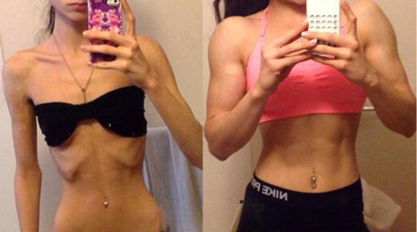 &Ccedil;ok zayıf olmak da zor: İşte kilo almak i&ccedil;in yapmanız gerekenler