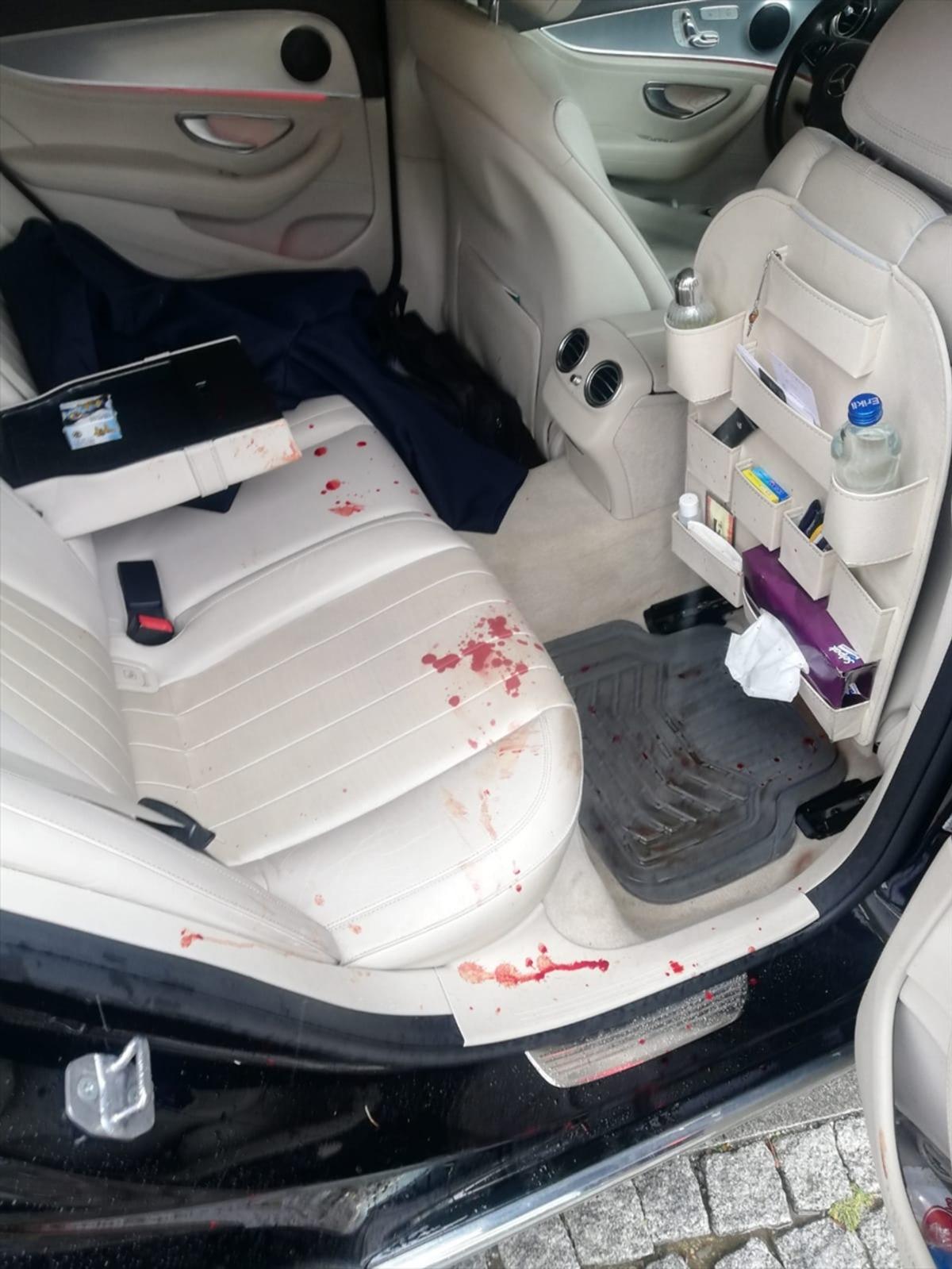 Gelecek Partisi Genel Başkan Yardımcısı &Ouml;zdağ saldırıya uğradı