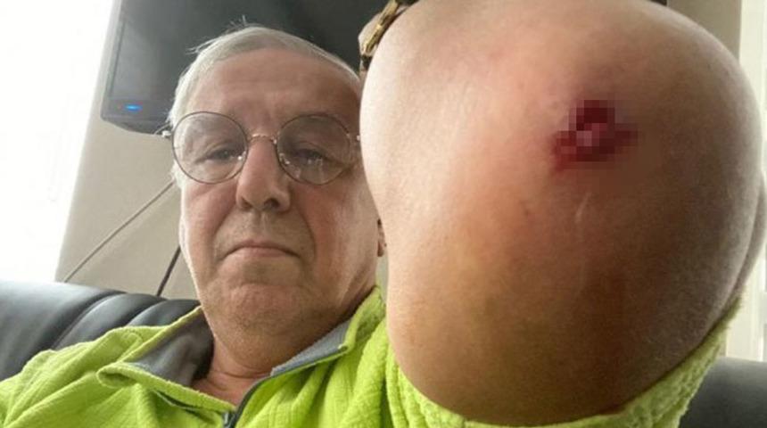 Yeniçağ Ankara Temsilcisi Orhan Uğuroğlu'na saldırı