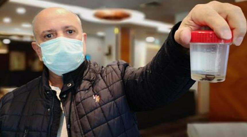 Kanser sanıldı! Akciğerinden 32 yıl sonra &ccedil;am fıstığı &ccedil;ıktı  