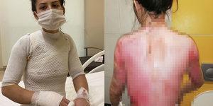 Kahvaltı i&ccedil;in uyandırdığı eşi onu bu hale getirdi