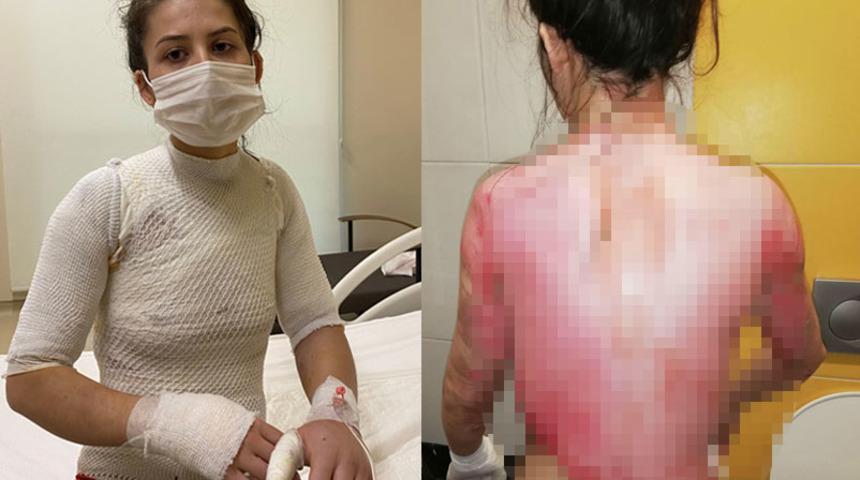 1,5 yaşındaki kızıyla eşinin &uuml;zerine kaynar su d&ouml;kt&uuml;, serbest bırakıldı