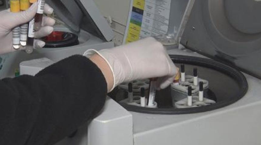 Aşı olmak i&ccedil;in antikor testi yaptırmaya gerek var mı? Uzman isimden a&ccedil;ıklama