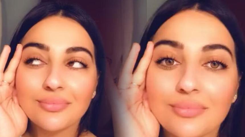 Burun estetiği sonrası ölüm! Manolya Oktay'ın ailesinden korkunç iddialar 