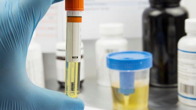 Kan testi ve idrar testiyle hamilelik nasıl belirlenir?