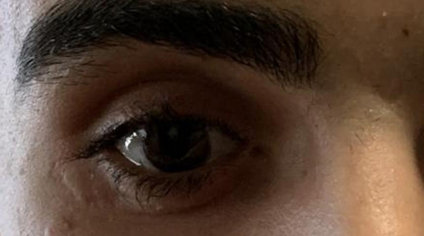 Ameliyatta unutulan cam kırığı yüzünden gözünü kaybetti