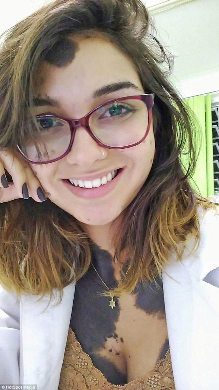 Diş çektirmeye gitti yüzünün yarısını kaybetti Diş çektirmeye gitti yüzünün yarısını kaybetti