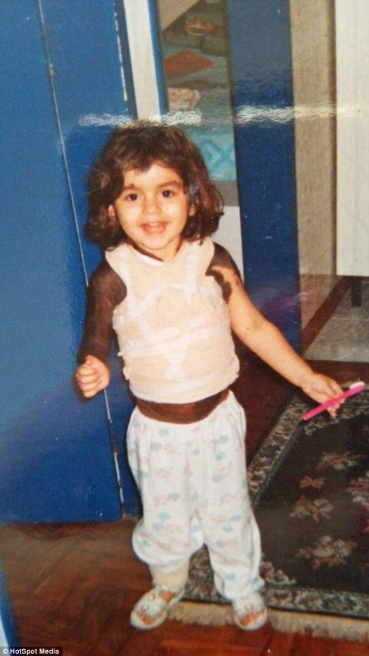 Diş çektirmeye gitti yüzünün yarısını kaybetti Diş çektirmeye gitti yüzünün yarısını kaybetti