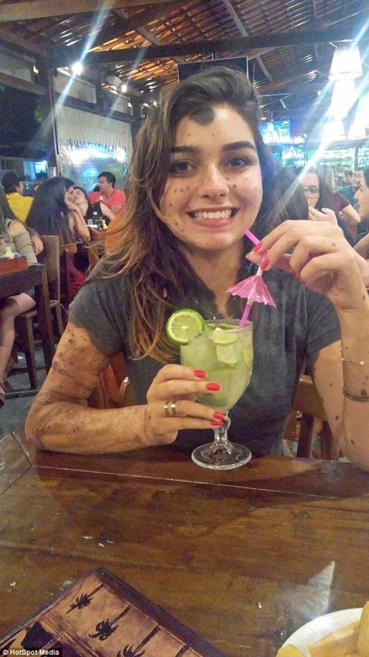 Diş çektirmeye gitti yüzünün yarısını kaybetti Diş çektirmeye gitti yüzünün yarısını kaybetti