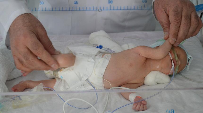 Kilosu kadar tümörle dünyaya gelen bebeğe ameliyat