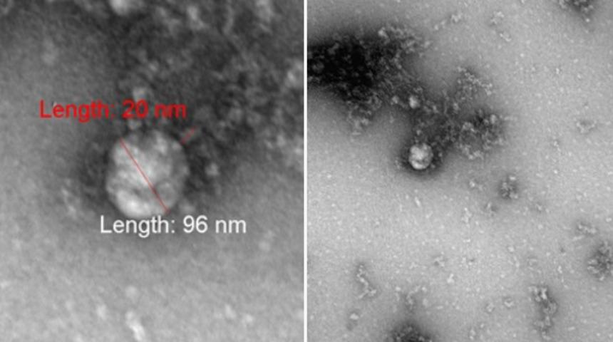 Dünyada bir ilk: Koronavirüs mutasyonunun fotoğrafını çekildi
