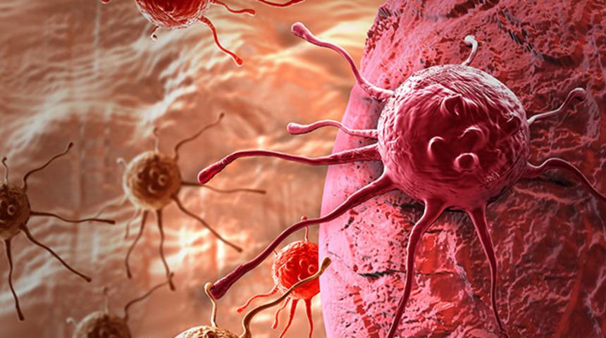 Gırtlak kanserinde iyileşme şansı