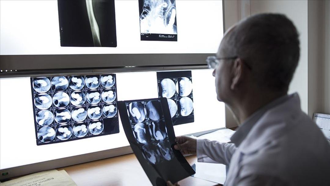 Genetik olarak kansere yatkın mısınız? Uzmanlardan 6 önemli tavsiye: Kanserden korunmak mümkün olabilir… 3