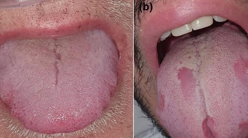 Koronadan şüpheleniyorsanız hemen aynaya bakın!