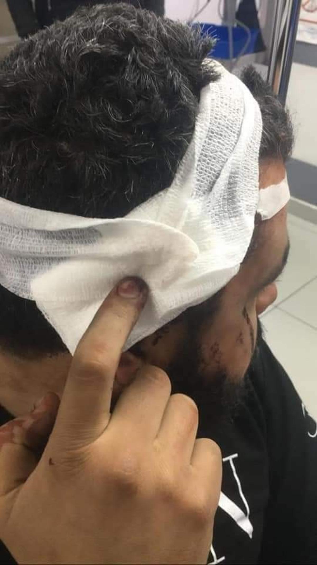 L&uuml;bnan&rsquo;da şiddetlenen protestolarda 220 yaralı