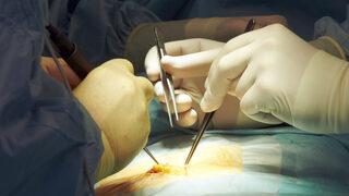 Kesi yeri fıtığı nedir? Kesi yeri fıtığının ameliyat dışında tedavisi var mıdır?