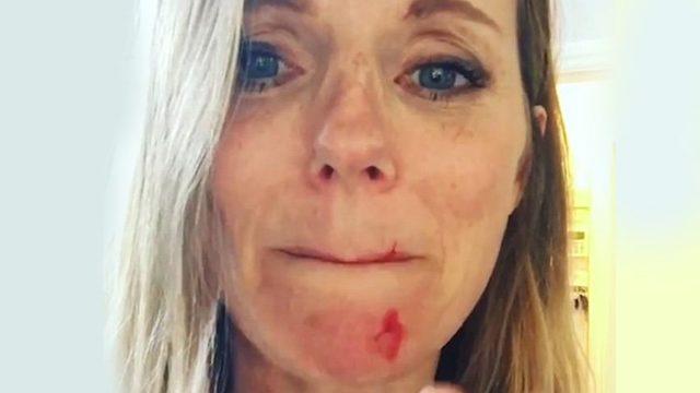 Geri’nin çenesi ve dudağının üzeri kan içinde kaldı