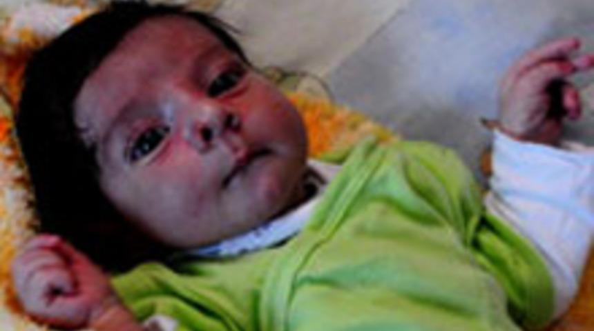 T&uuml;rk Doktorların Mucizesi